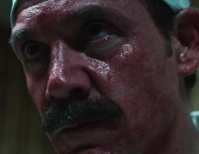 Actor Jamie Sives, in HBOs Chernobyl, plays Anatoly Sitnikov, a plant worker who died from ARS