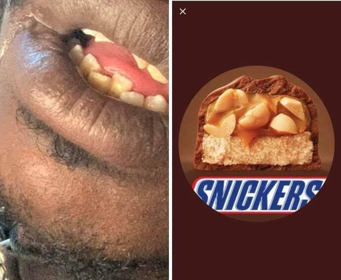 If you eat a lot of sweets and candy, do you still have all your teeth?
