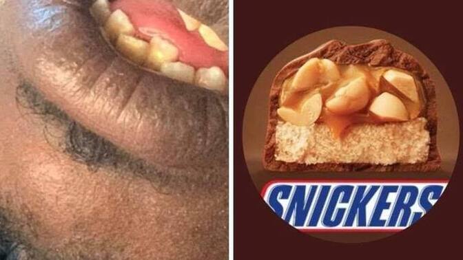 If you eat a lot of sweets and candy, do you still have all your teeth?