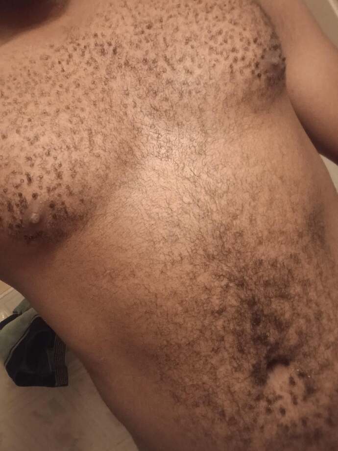 What type of chest hair on men?