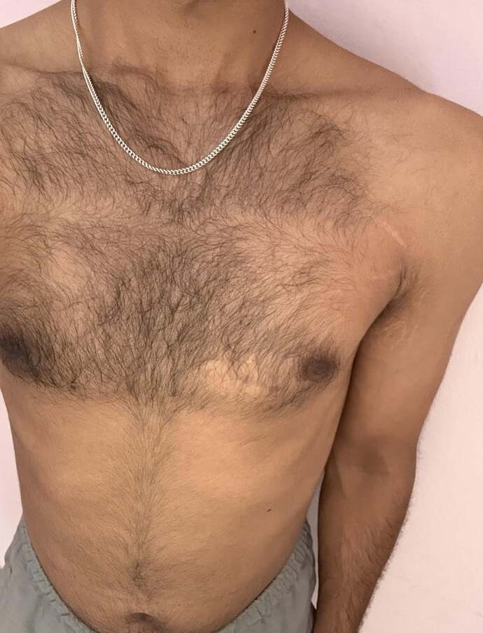 What type of chest hair on men?