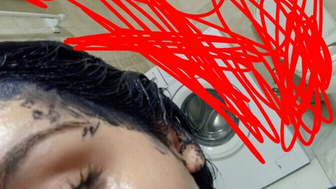Just dyed my hair how do I get these dye stains off? would cigarette ash work?