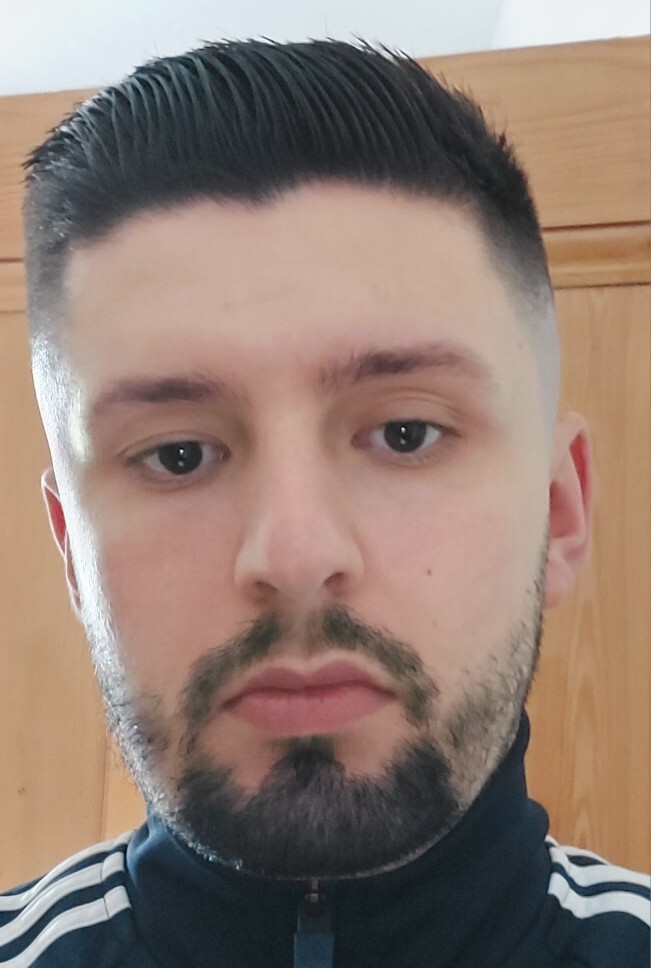 Which facial features are making me look so unattractive to women?