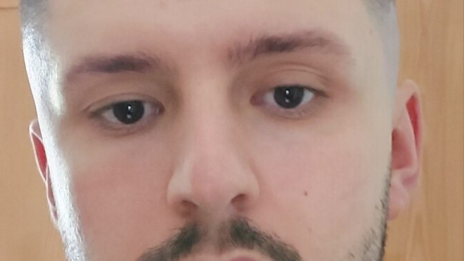 Which facial features are making me look so unattractive to women?