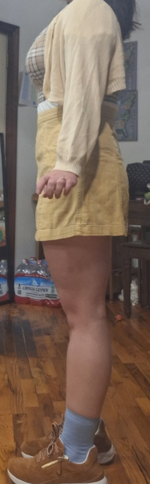 How worried should I be about knee hyperextension and knock knees?