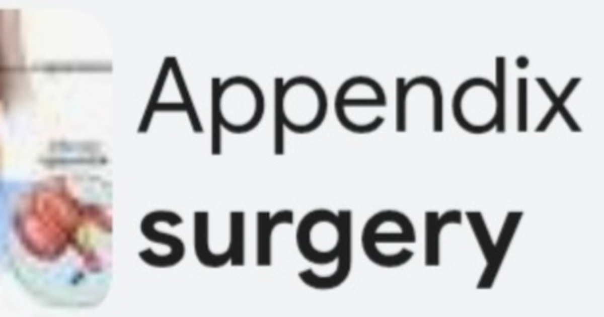 Appendix Imaging Have You Had Your Appendix Removed? - GirlsAskGuys
