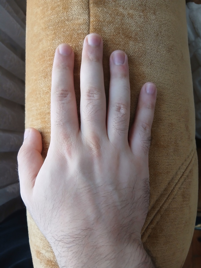Girls, do you care about hand/arm hair?