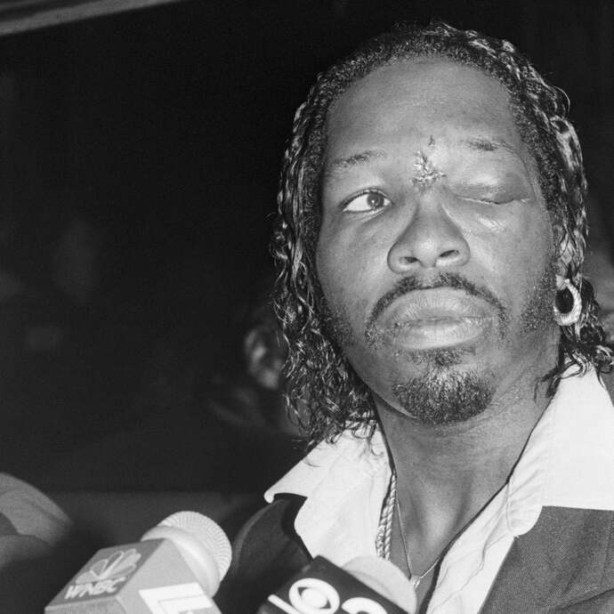 This is Mitch Green and this is what Mike did to his eye in 1988 in a street fight, ungloved.