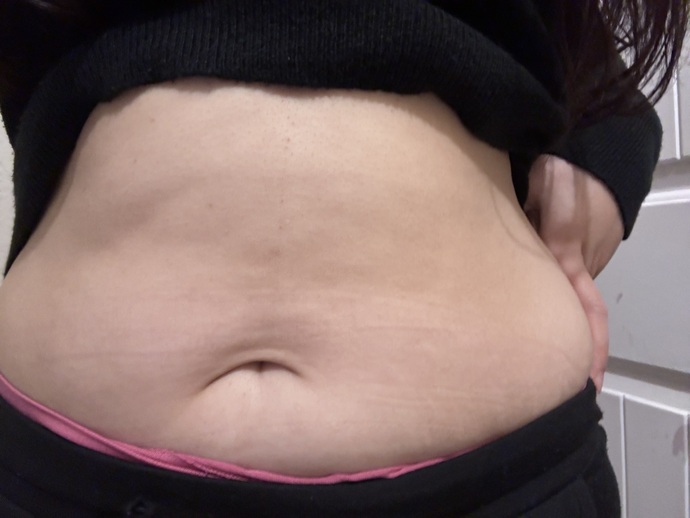 How do I deal with the fact that I will never have flat stomach? Is it possible for me to lose weight in my breasts?