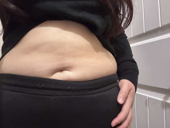 How do I deal with the fact that I will never have flat stomach? Is it possible for me to lose weight in my breasts?