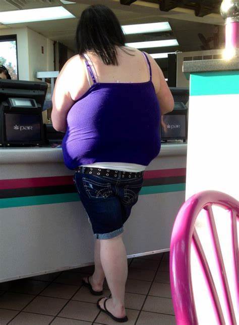 Thick legs