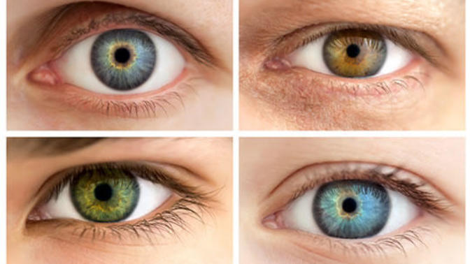 Most Attractive Eye Color [Poll Results]?