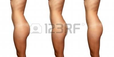 body side view